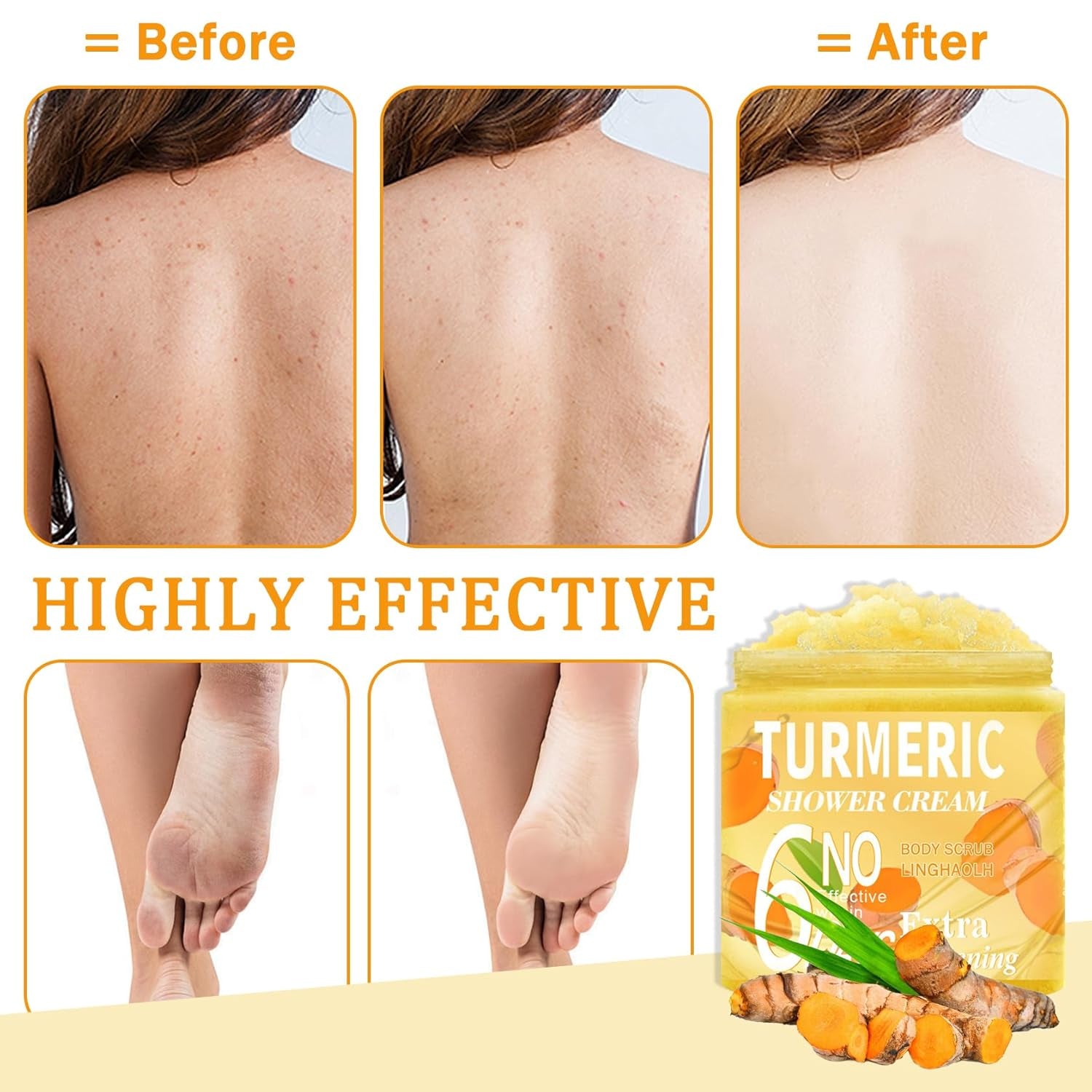 Turmeric Body Scrub,Deep Cleansing Exfoliating Scrub for Body,Hand and Foot,Moisturizing Face Body Scrub Skincare for Women and Men,12.3 Oz